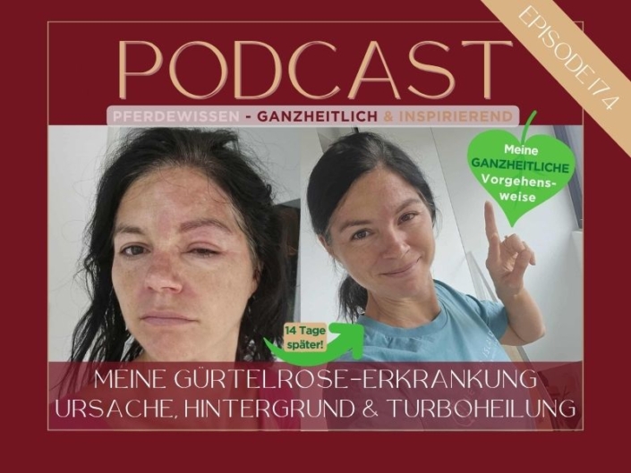 Podcastfolge 174 – Meine Gürtelrose-Erkrankung